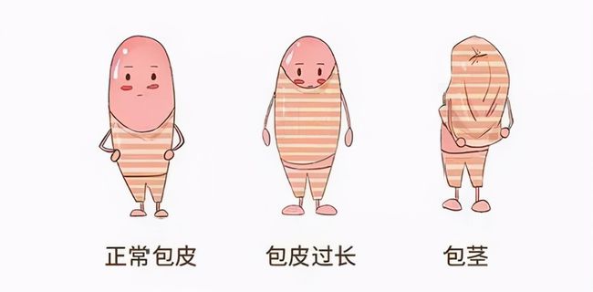 儿童包皮一定要切吗,九游娱乐（NineGame）手游平台